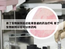 用了生物制剂后还能用普通的药治疗吗 用了生物制剂以后可以停药吗