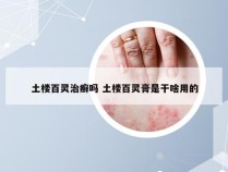 土楼百灵治癣吗 土楼百灵膏是干啥用的