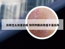 白斑怎么快速去除 如何判断白斑是不是白风