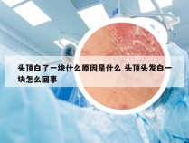 头顶白了一块什么原因是什么 头顶头发白一块怎么回事