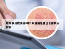 银屑病润肤油哪种好 银屑病患者适合用的润肤乳