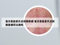 复方氨肽素片点状银屑病 复方氨肽素片点状银屑病可以用吗