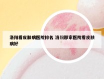 洛阳看皮肤病医院排名 洛阳那家医院看皮肤病好