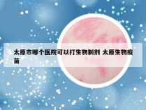 太原市哪个医院可以打生物制剂 太原生物疫苗