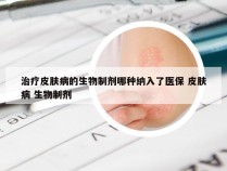 治疗皮肤病的生物制剂哪种纳入了医保 皮肤病 生物制剂