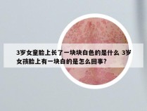 3岁女童脸上长了一块块白色的是什么 3岁女孩脸上有一块白的是怎么回事?