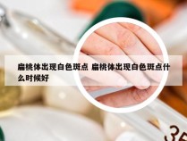 扁桃体出现白色斑点 扁桃体出现白色斑点什么时候好