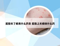 屁股长了癣用什么药膏 屁股上长癣抹什么药