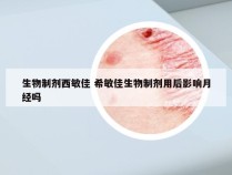 生物制剂西敏佳 希敏佳生物制剂用后影响月经吗