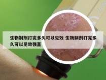 生物制剂打完多久可以见效 生物制剂打完多久可以见效强直