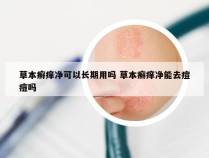 草本癣痒净可以长期用吗 草本癣痒净能去痘痘吗