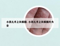 小孩儿手上长癣图. 小孩儿手上长癣图片大全