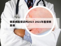 银屑病医保谈判2023 2021年医保银屑病