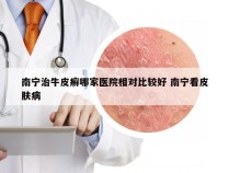 南宁治牛皮癣哪家医院相对比较好 南宁看皮肤病