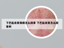 下巴起皮屑像癣怎么回事 下巴起皮屑怎么回事啊