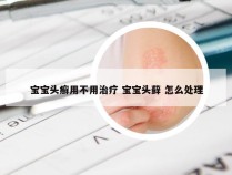 宝宝头癣用不用治疗 宝宝头藓 怎么处理