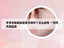 冬季皮肤就起癣夏天就好了怎么回事 一到冬天就起藓