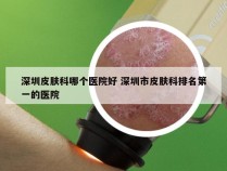 深圳皮肤科哪个医院好 深圳市皮肤科排名第一的医院