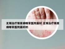 无锡治疗银屑病哪家医院最好 无锡治疗银屑病哪家医院最好的