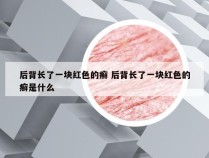 后背长了一块红色的癣 后背长了一块红色的癣是什么