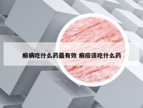 癣病吃什么药最有效 癣应该吃什么药