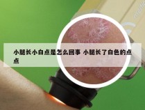 小腿长小白点是怎么回事 小腿长了白色的点点