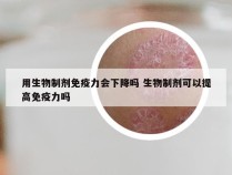 用生物制剂免疫力会下降吗 生物制剂可以提高免疫力吗