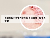 白斑多久不会变大就没事 白点癫风一般多久扩散