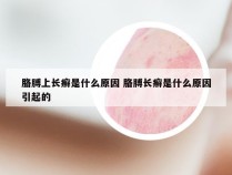 胳膊上长癣是什么原因 胳膊长癣是什么原因引起的