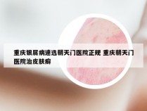 重庆银屑病速选朝天门医院正规 重庆朝天门医院治皮肤癣