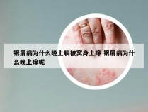 银屑病为什么晚上躺被窝身上痒 银屑病为什么晚上痒呢