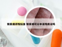 银屑病评残标准 银屑病可以申请残疾证吗