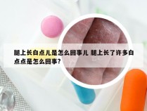 腿上长白点儿是怎么回事儿 腿上长了许多白点点是怎么回事?