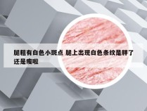 腿粗有白色小斑点 腿上出现白色条纹是胖了还是瘦啦