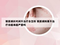 银屑病长时间不治疗会怎样 银屑病如果不治疗会越来越严重吗