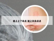 腿上上了白点 腿上长白点点