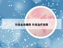 针灸去白癜风 针灸治疗白斑