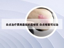 白点治疗费用最低的是哪家 白点哪里可以治