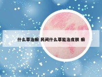 什么草治癣 民间什么草能治皮肤 癣