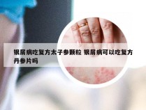 银屑病吃复方太子参颗粒 银屑病可以吃复方丹参片吗