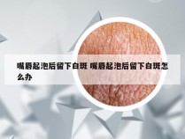 嘴唇起泡后留下白斑 嘴唇起泡后留下白斑怎么办