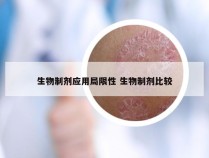 生物制剂应用局限性 生物制剂比较