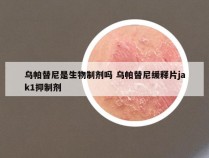 乌帕替尼是生物制剂吗 乌帕替尼缓释片jak1抑制剂