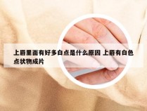 上唇里面有好多白点是什么原因 上唇有白色点状物成片