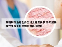 生物制剂治疗全身型幻儿特发关节 幼年型特发性关节炎打生物制剂最佳时机