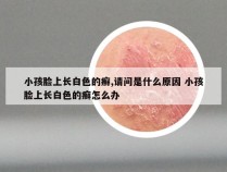 小孩脸上长白色的癣,请问是什么原因 小孩脸上长白色的癣怎么办