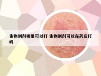 生物制剂哪里可以打 生物制剂可以在药店打吗