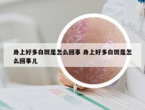 身上好多白斑是怎么回事 身上好多白斑是怎么回事儿