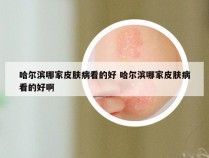 哈尔滨哪家皮肤病看的好 哈尔滨哪家皮肤病看的好啊