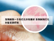 生物制剂一个月打几针效果好 生物制剂打几针能见到疗效